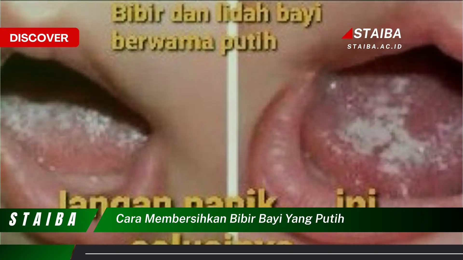 Temukan Cara Menakjubkan Membersihkan Bibir Bayi yang Putih