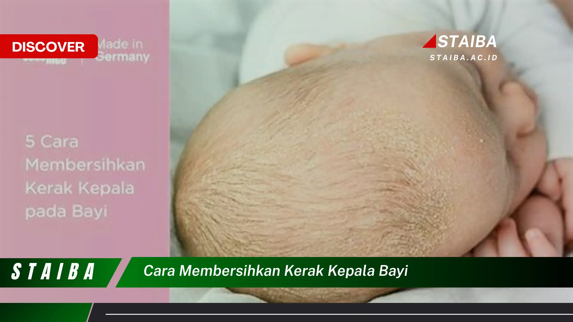 cara membersihkan kerak kepala bayi