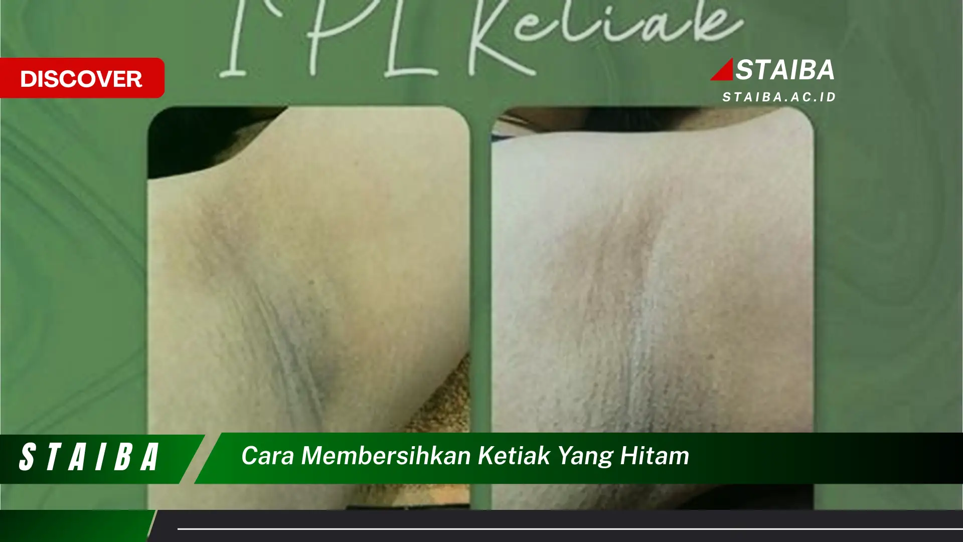 cara membersihkan ketiak yang hitam