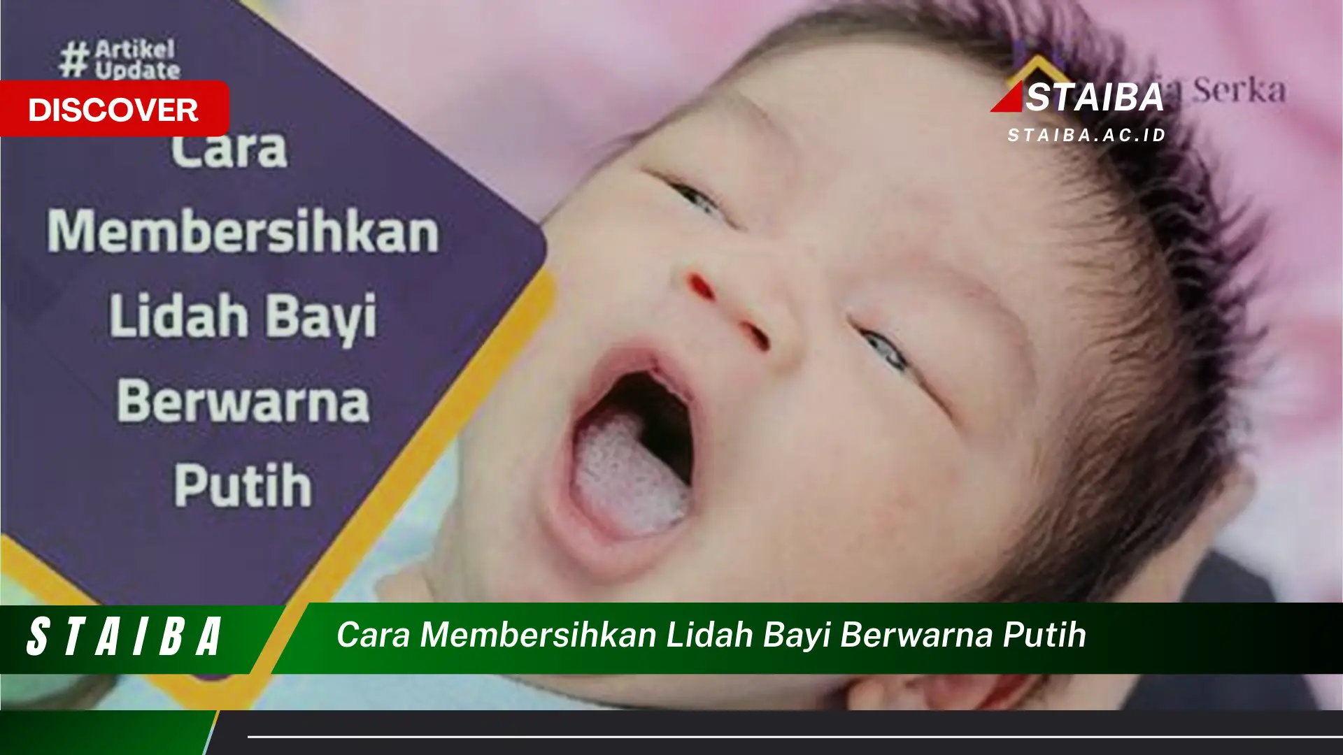 cara membersihkan lidah bayi berwarna putih