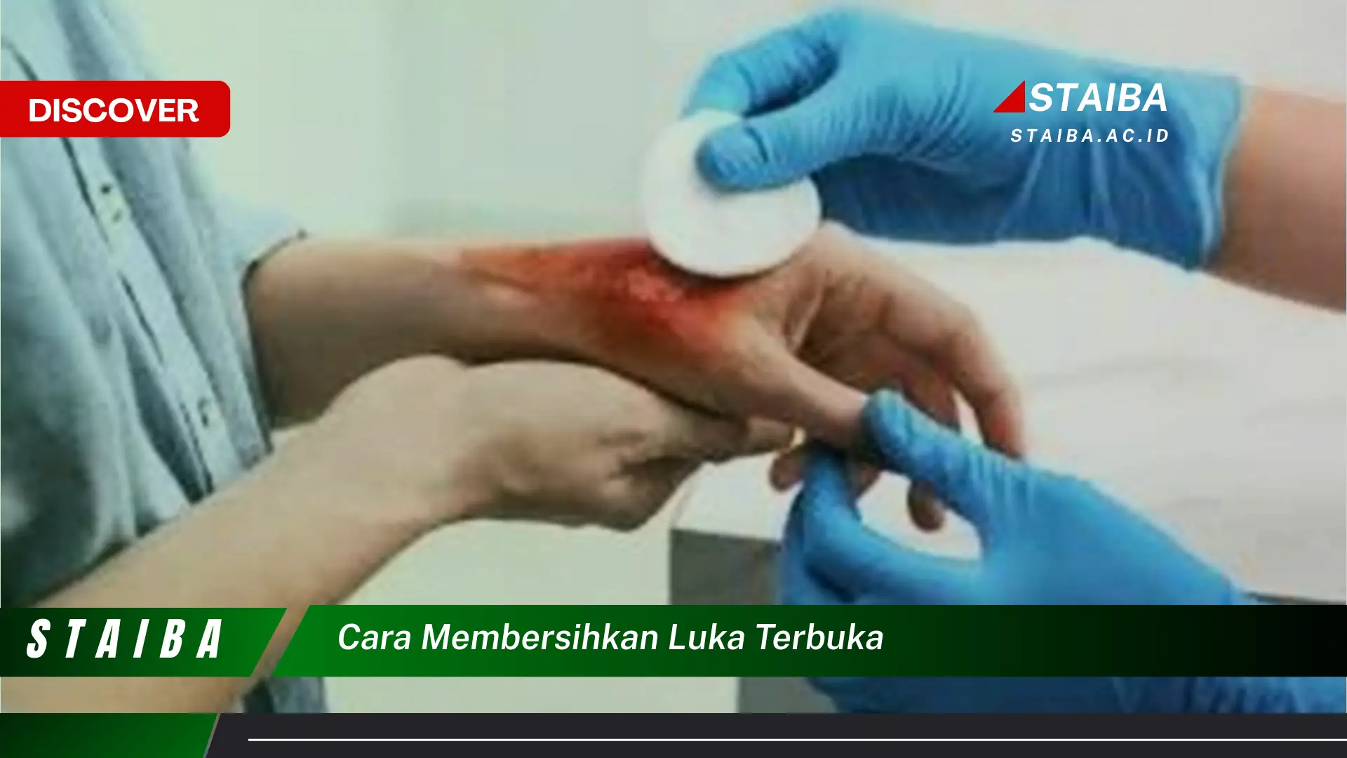 cara membersihkan luka terbuka