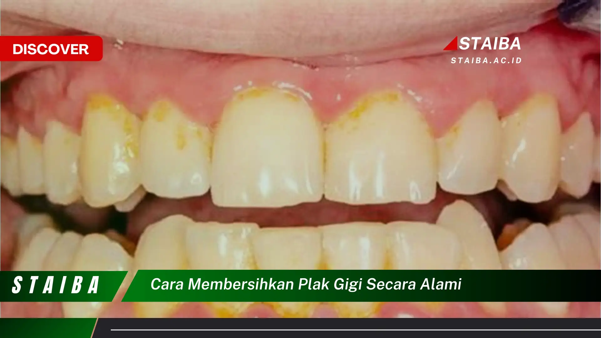 cara membersihkan plak gigi secara alami