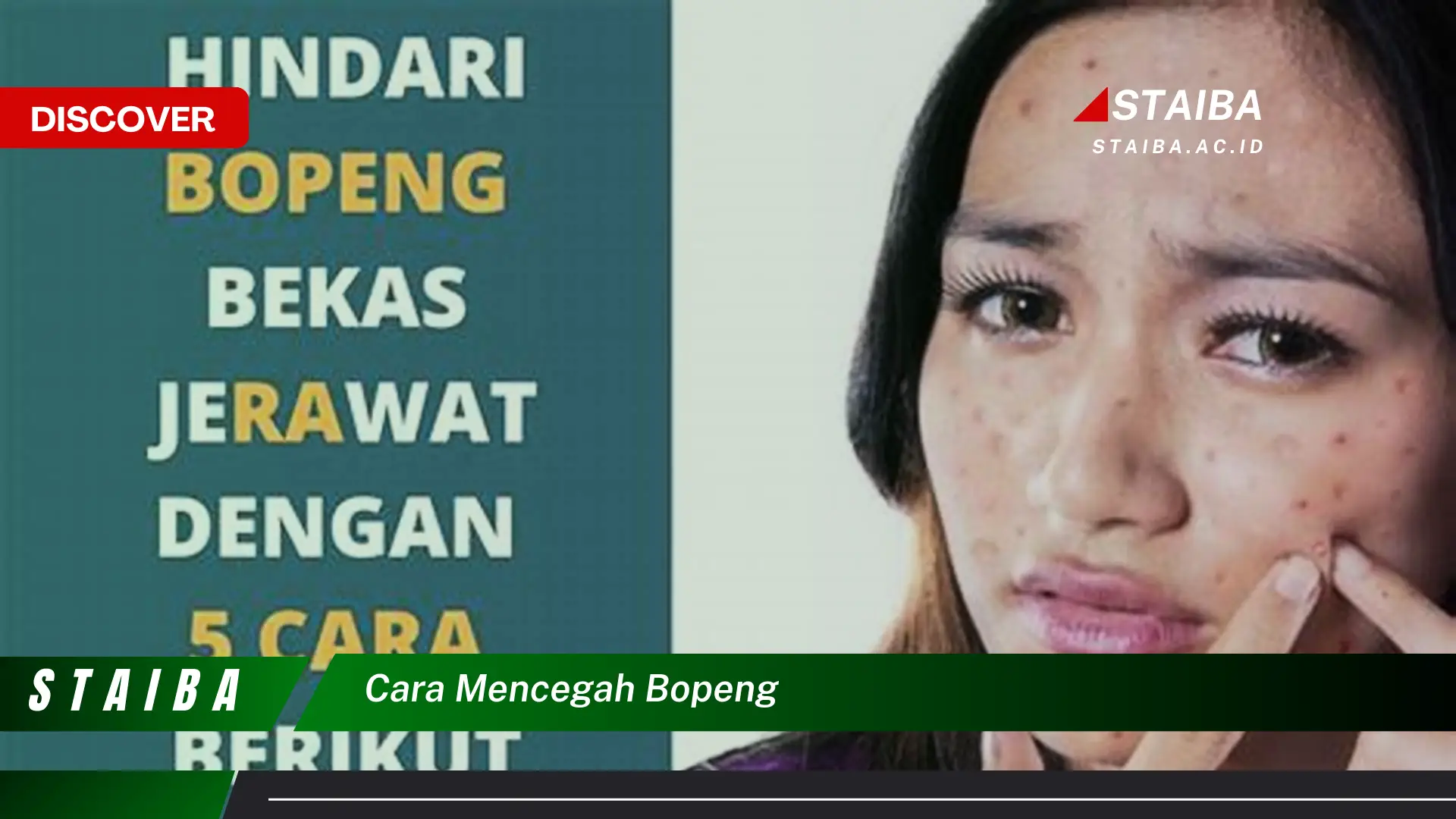 cara mencegah bopeng