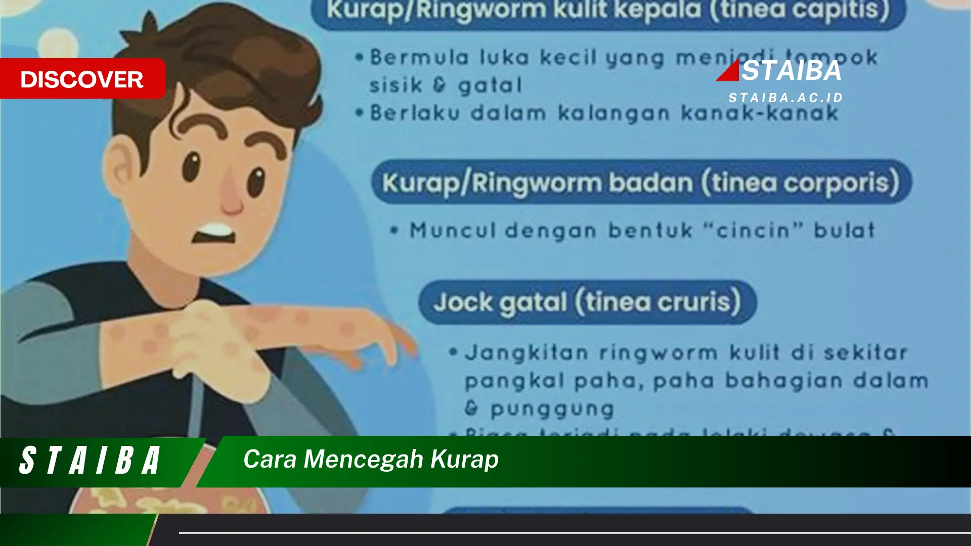 cara mencegah kurap