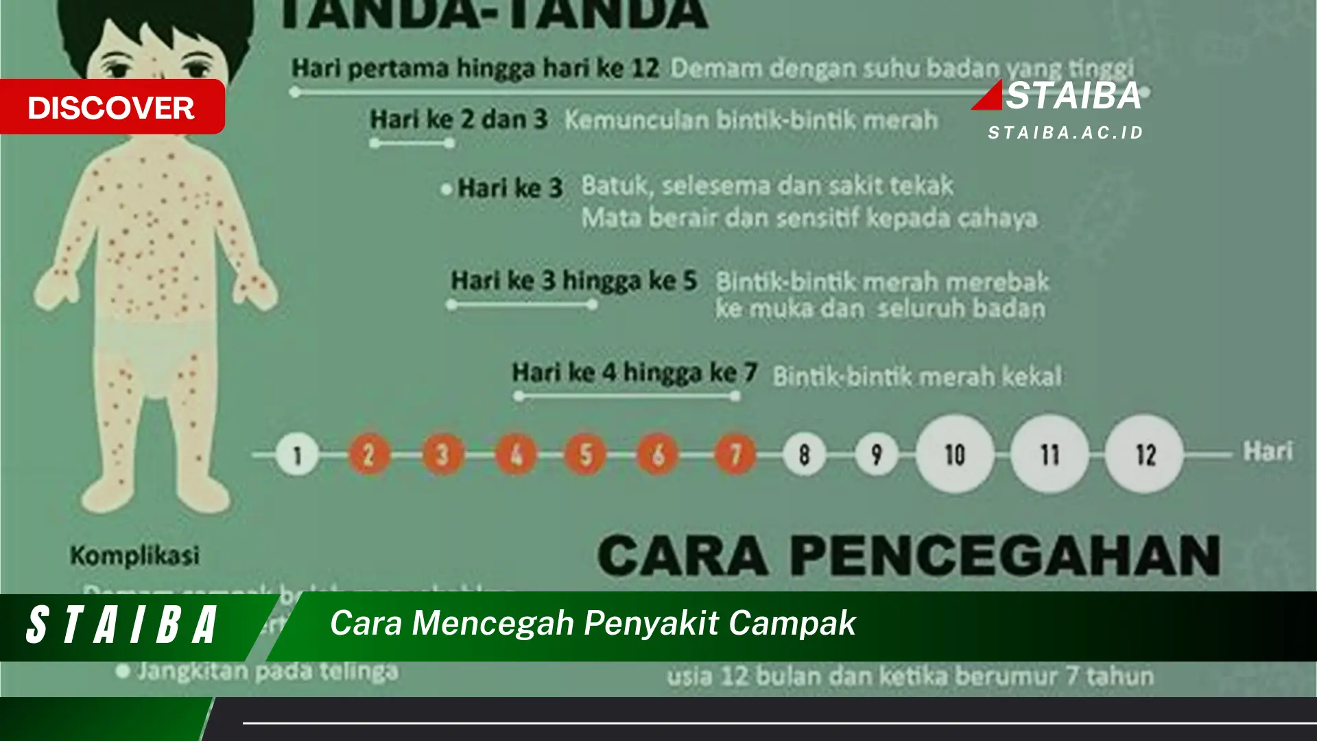 cara mencegah penyakit campak