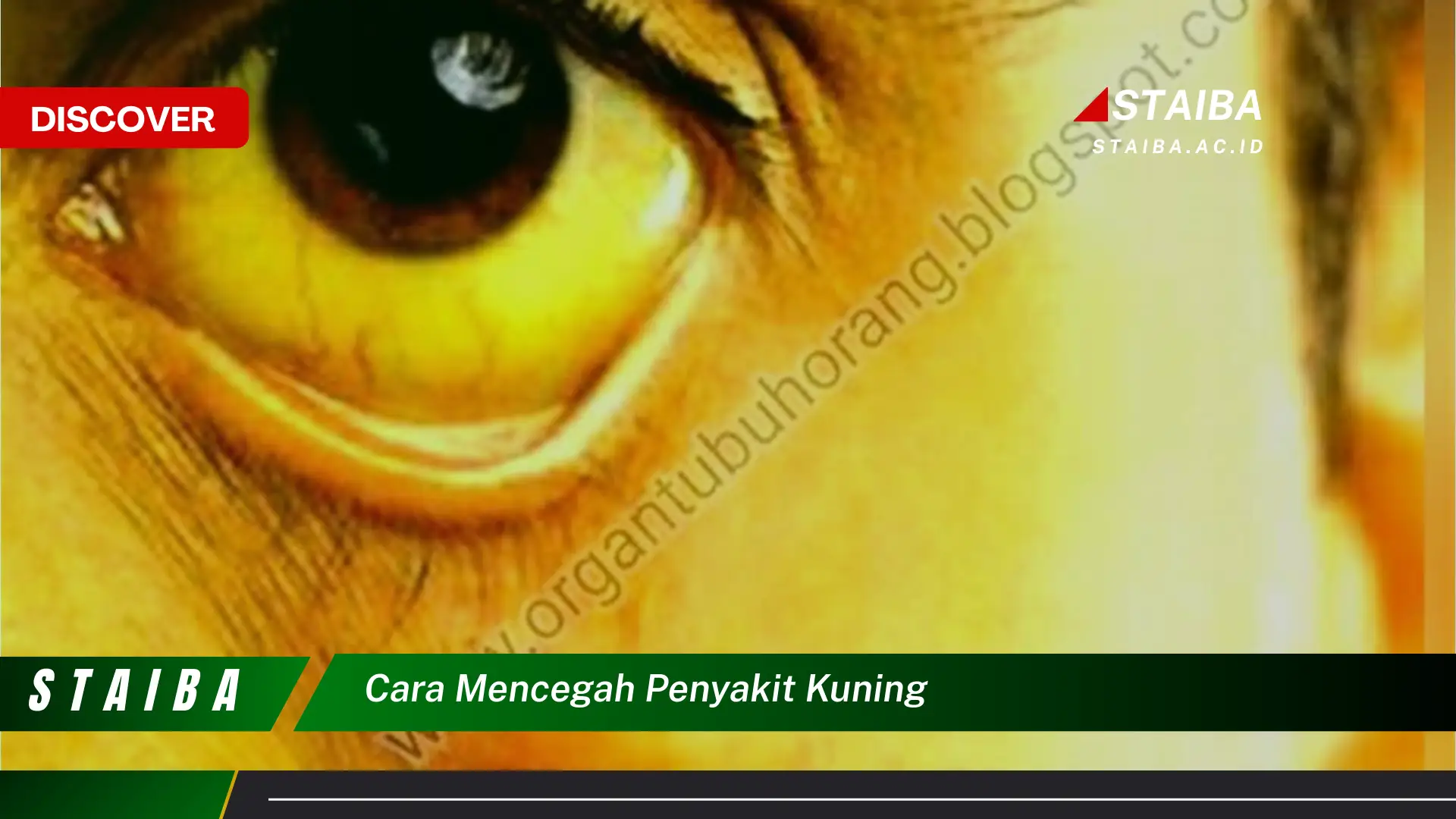 cara mencegah penyakit kuning