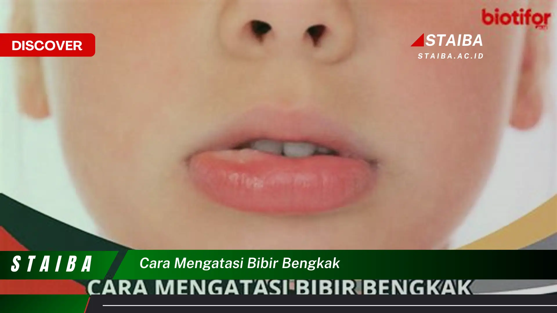 cara mengatasi bibir bengkak