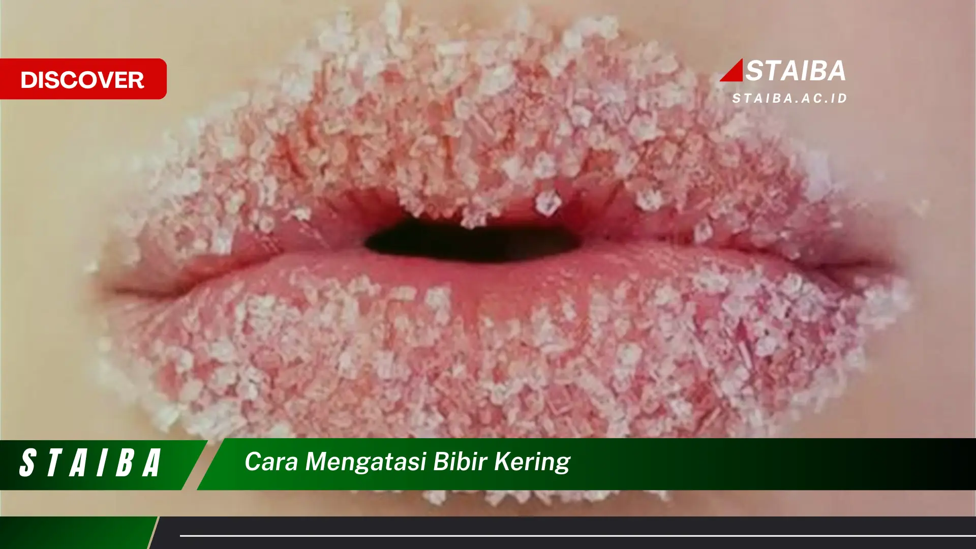 cara mengatasi bibir kering