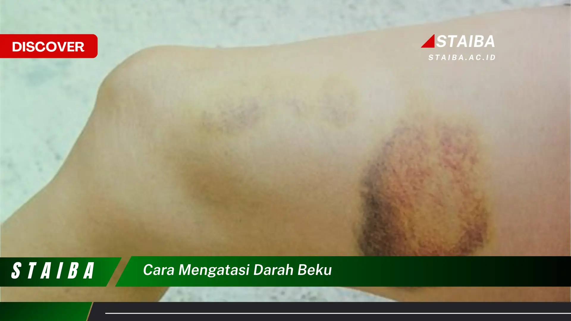 cara mengatasi darah beku