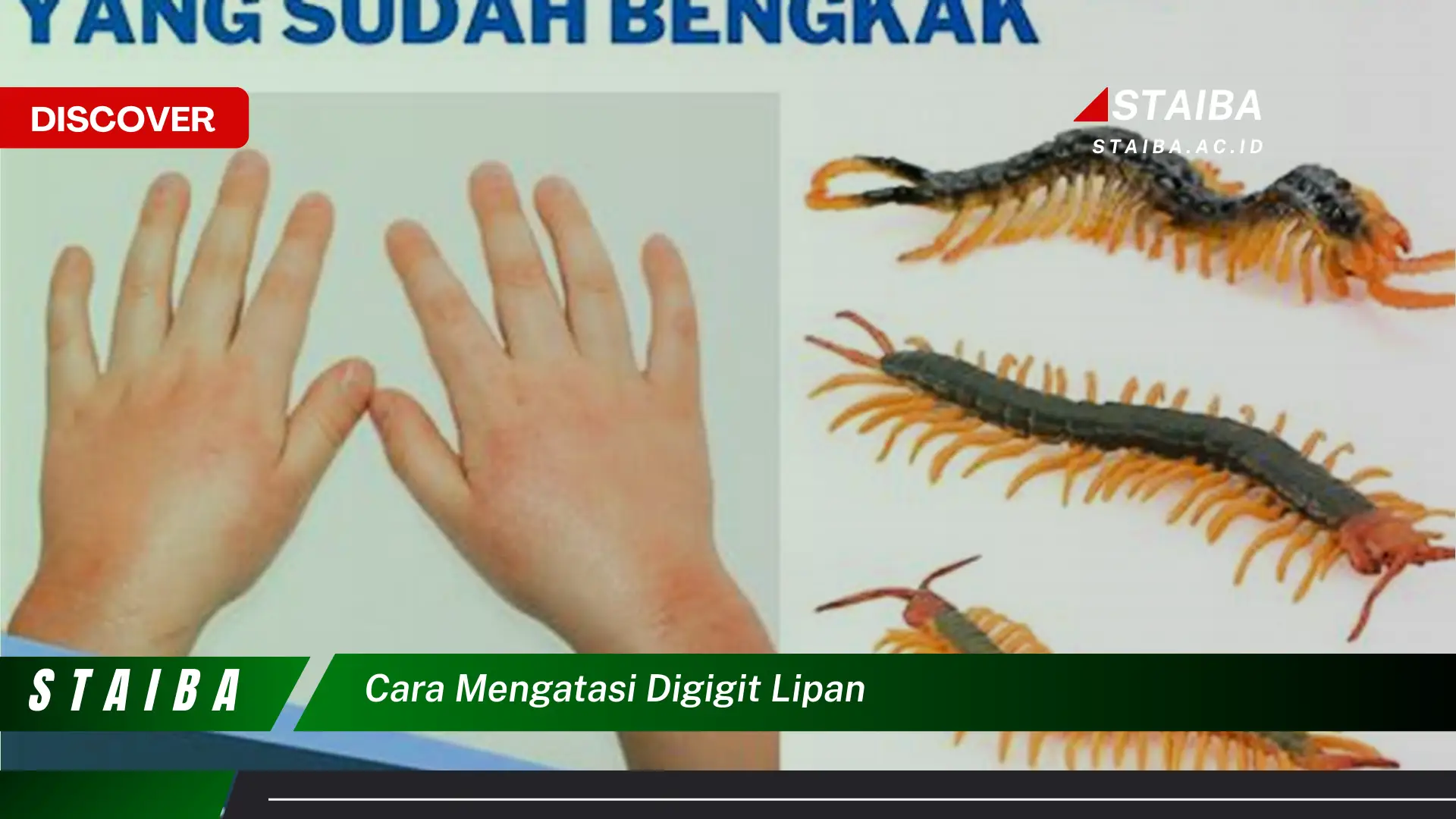 cara mengatasi digigit lipan cara mengatasi digigit lipan
