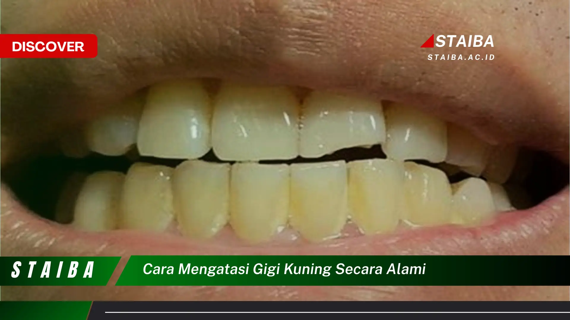 cara mengatasi gigi kuning secara alami