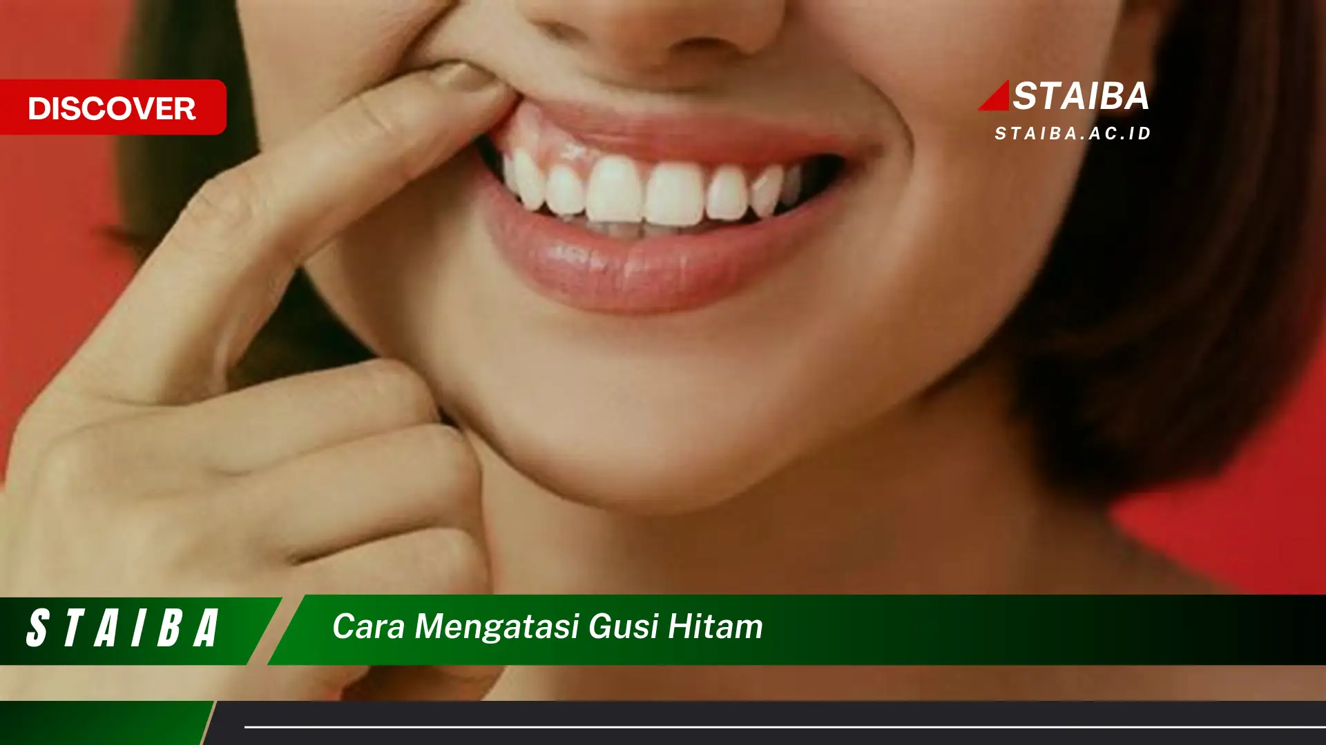 cara mengatasi gusi hitam