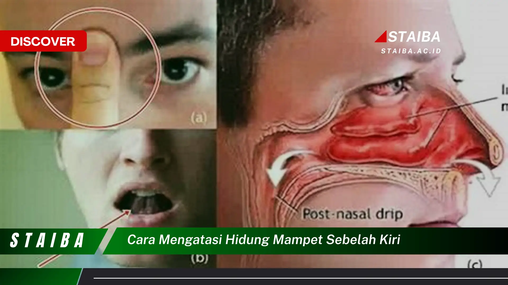 cara mengatasi hidung mampet sebelah kiri