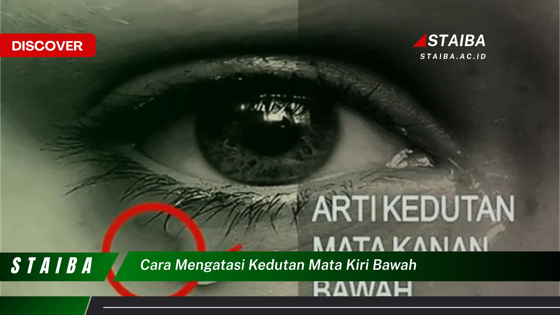 cara mengatasi kedutan mata kiri bawah