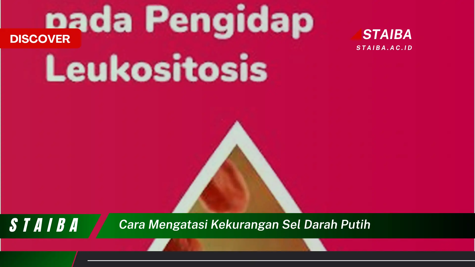 cara mengatasi kekurangan sel darah putih