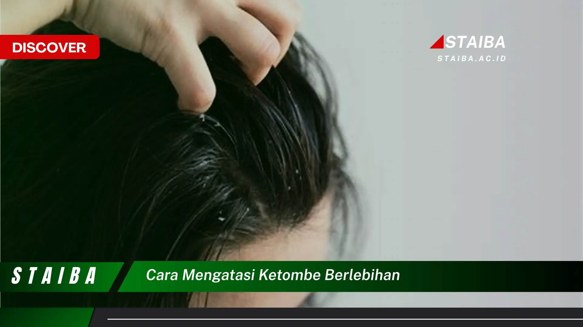 cara mengatasi ketombe berlebihan