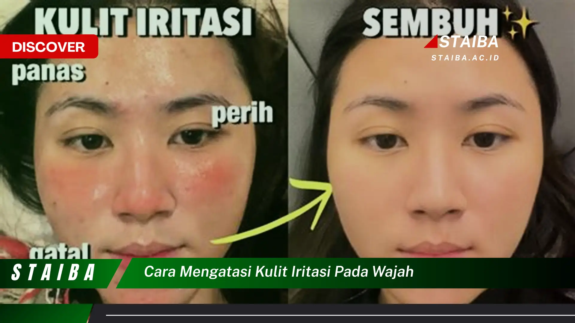 cara mengatasi kulit iritasi pada wajah