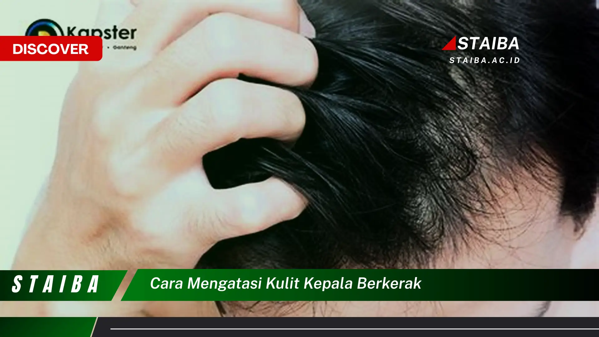 cara mengatasi kulit kepala berkerak