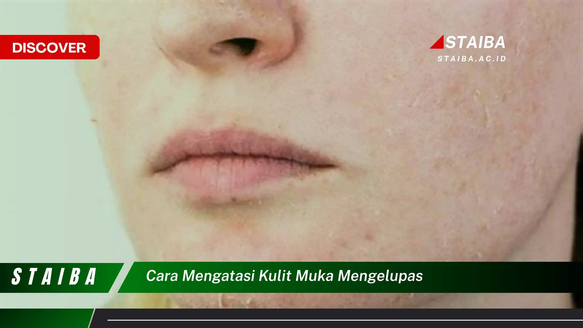 cara mengatasi kulit muka mengelupas