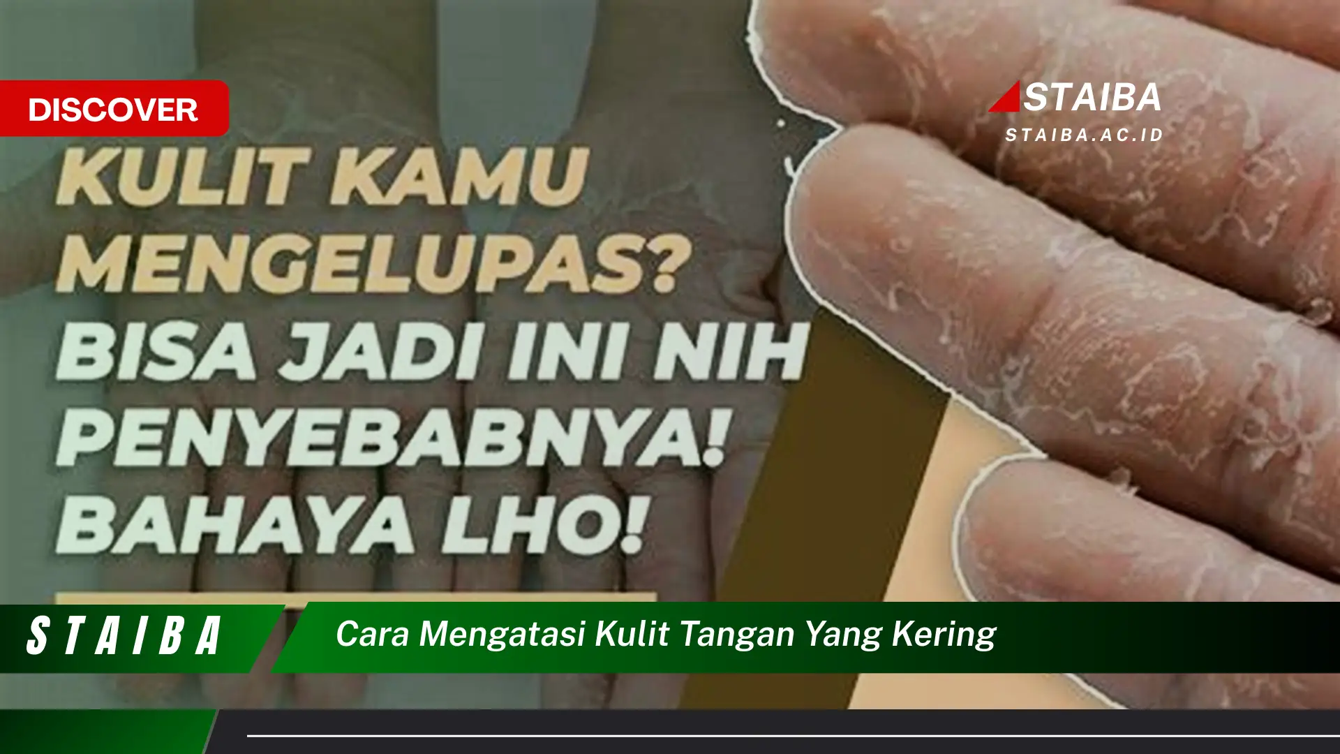 cara mengatasi kulit tangan yang kering