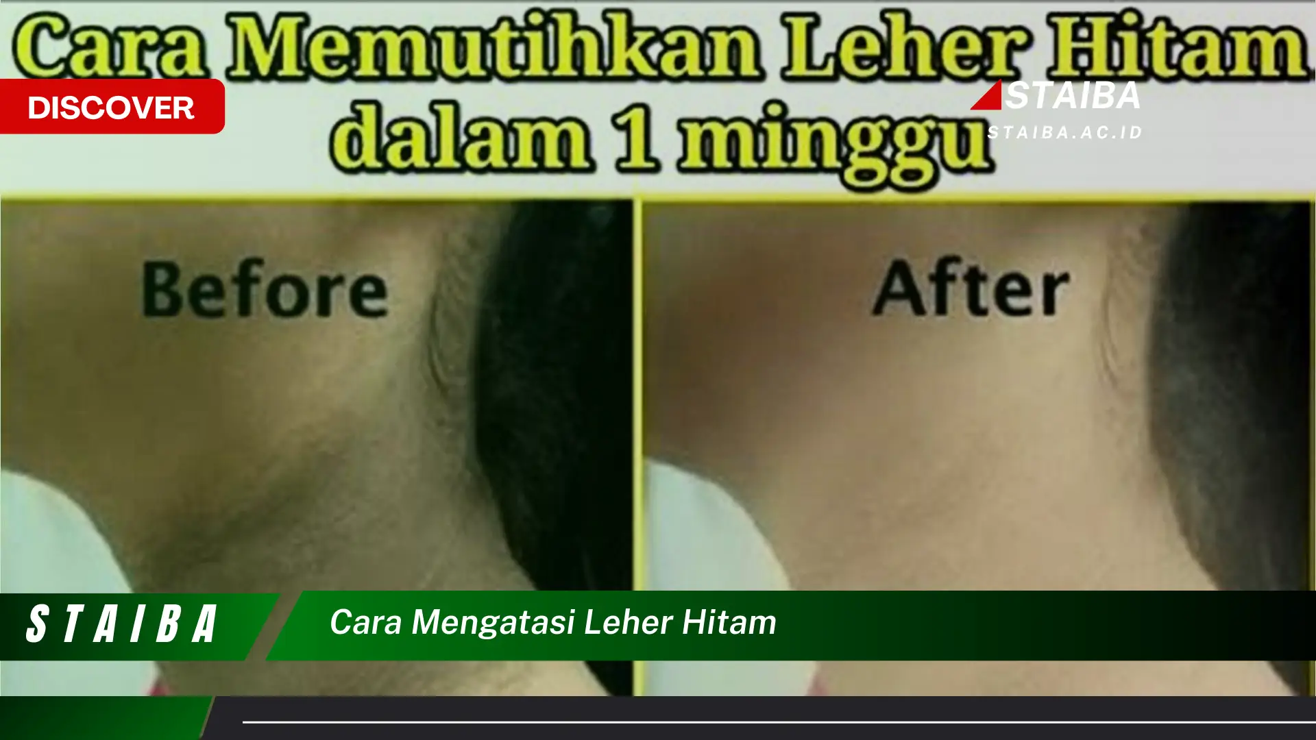 cara mengatasi leher hitam