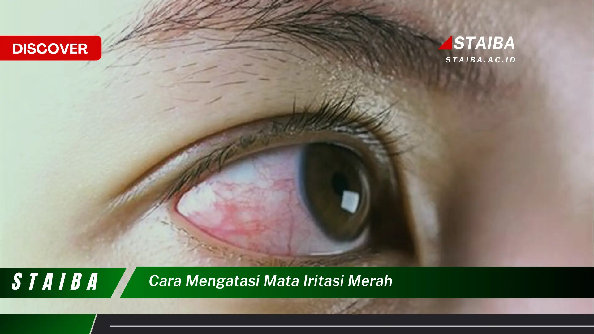 cara mengatasi mata iritasi merah