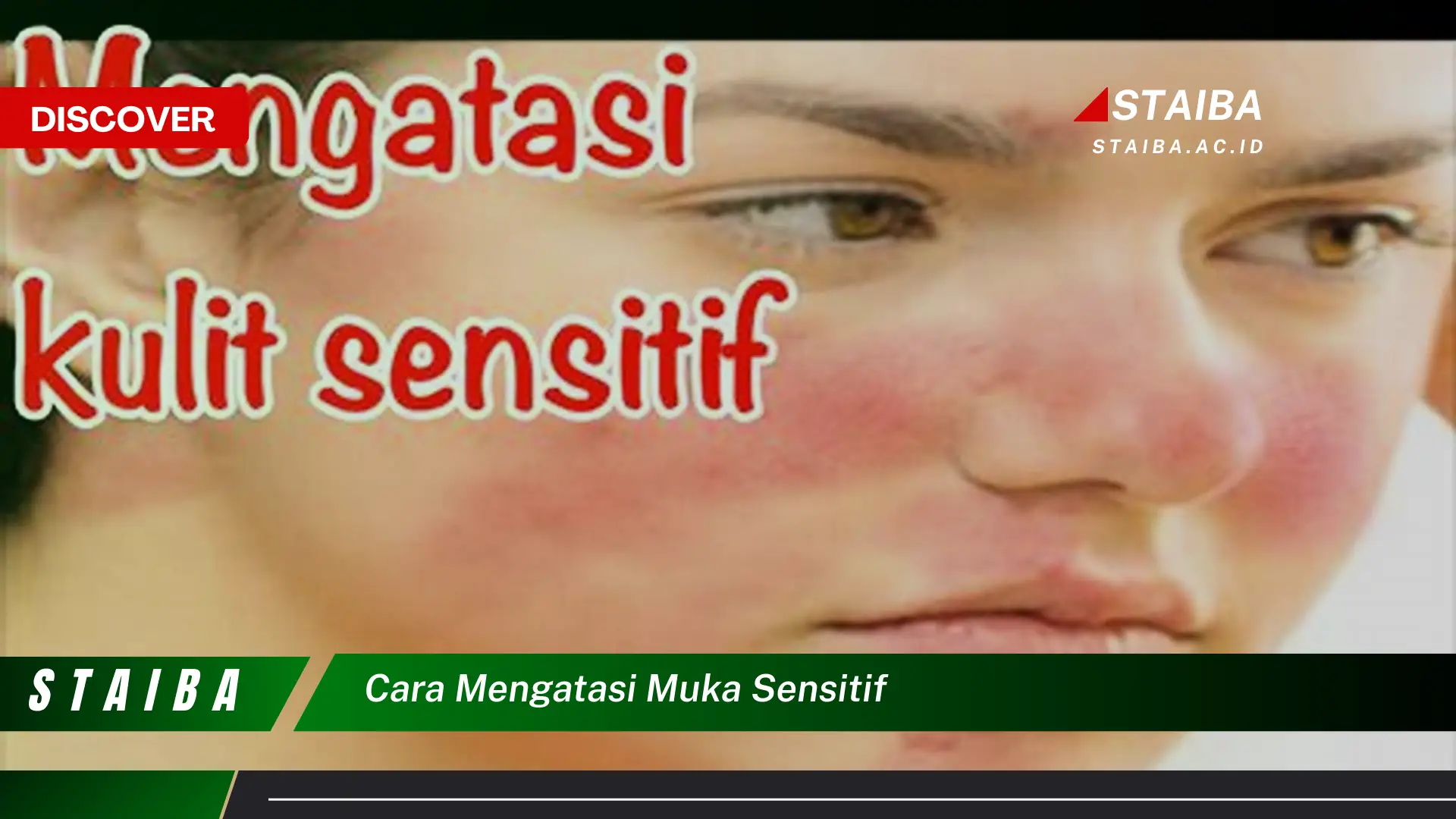 cara mengatasi muka sensitif