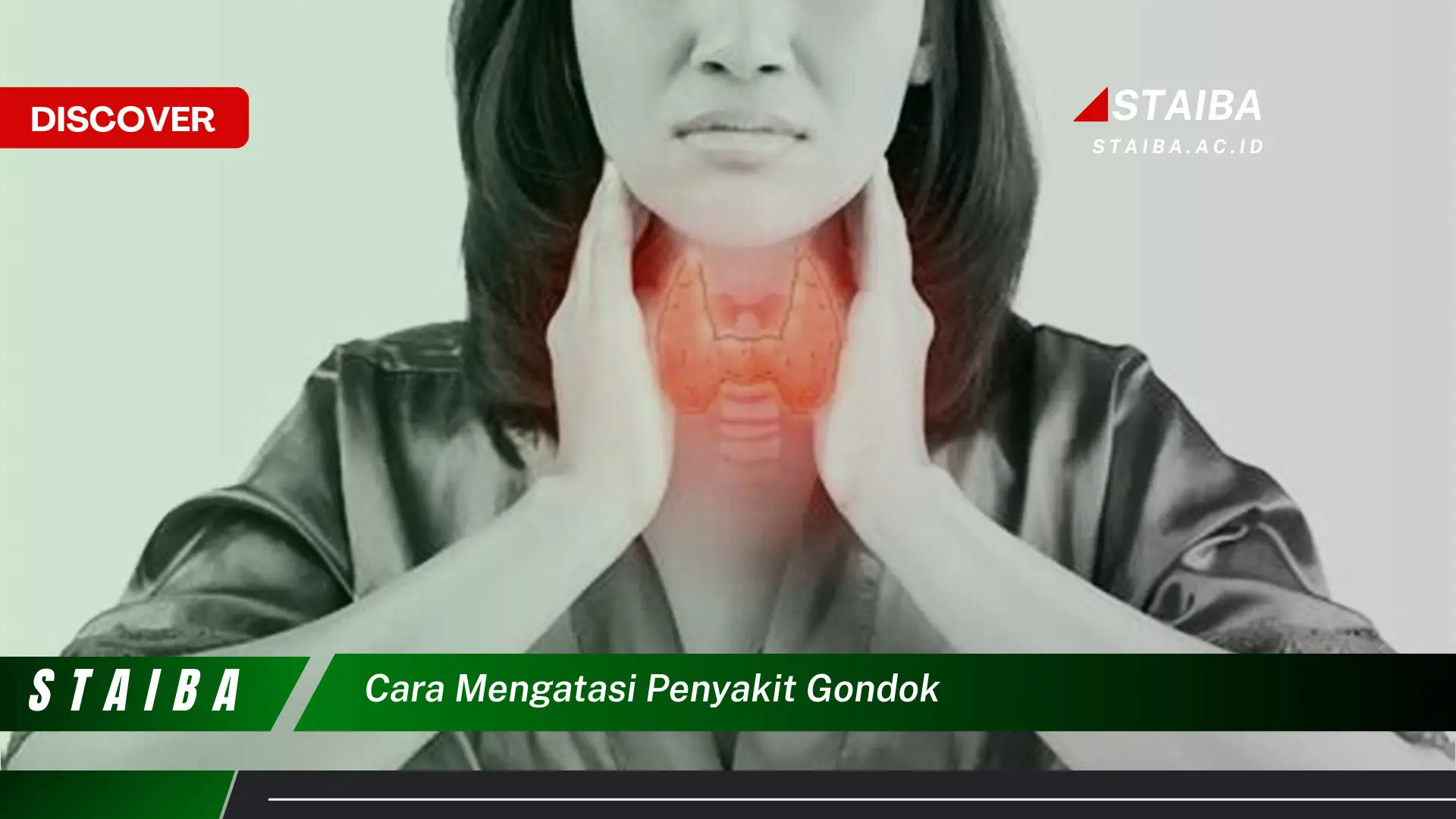 cara mengatasi penyakit gondok