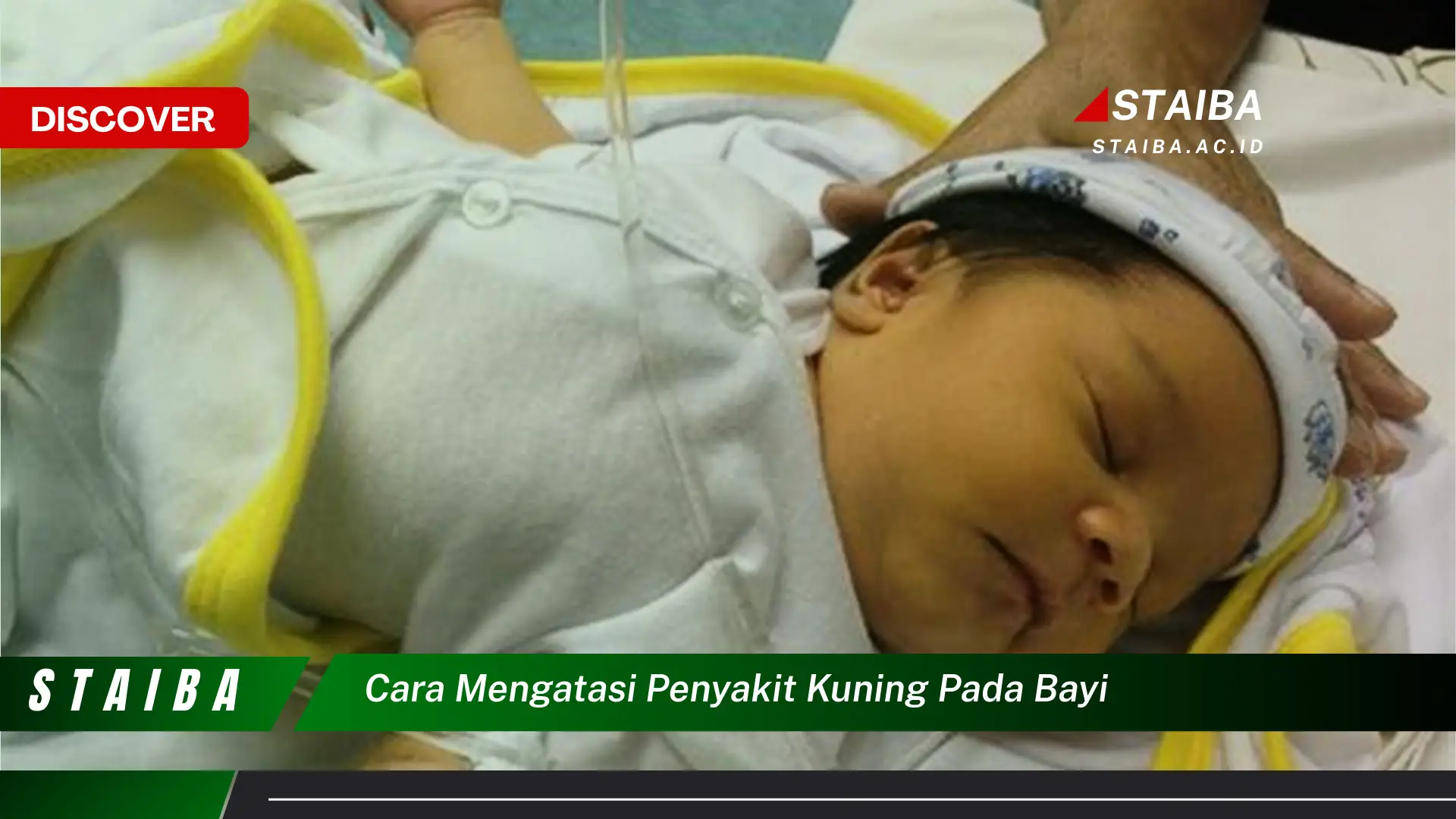 cara mengatasi penyakit kuning pada bayi