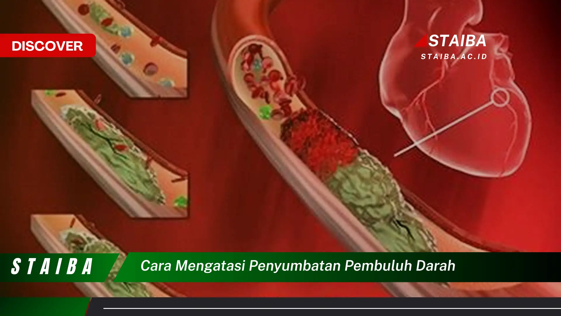 cara mengatasi penyumbatan pembuluh darah cara mengatasi penyumbatan pembuluh darah