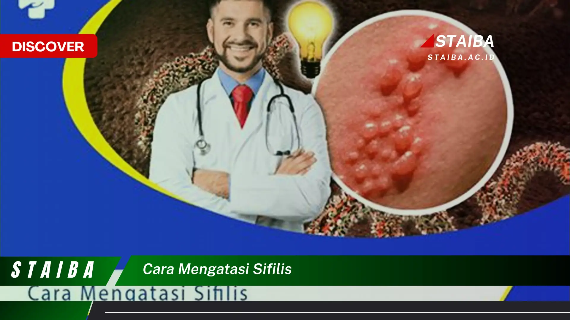 Temukan Cara Mengatasi Sifilis yang Jarang Diketahui