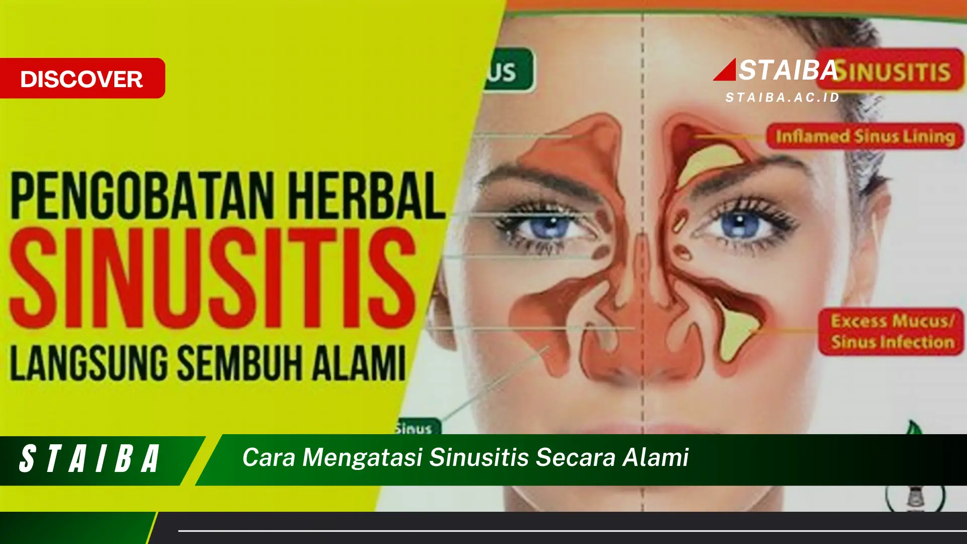 cara mengatasi sinusitis secara alami