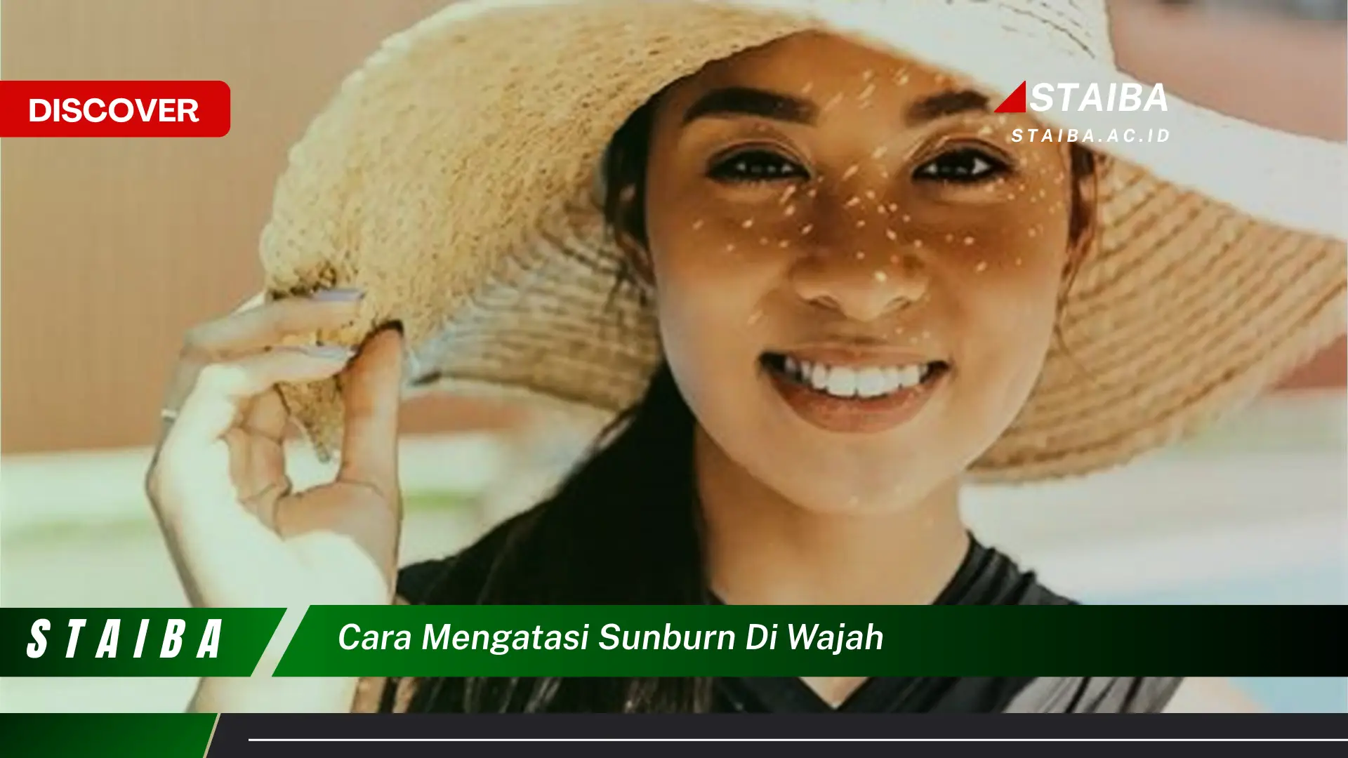 Ketahui Cara Mengatasi Sunburn di Wajah yang Jarang Diketahui