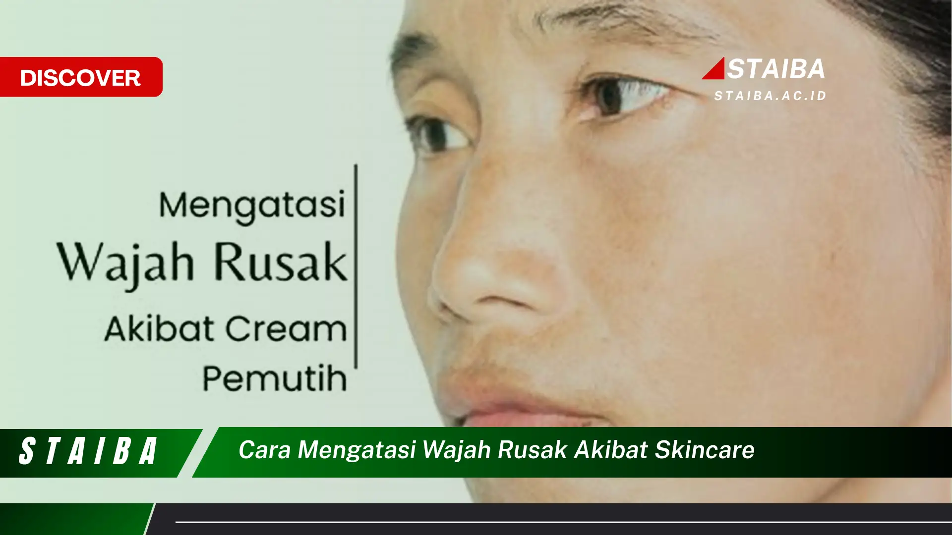 cara mengatasi wajah rusak akibat skincare