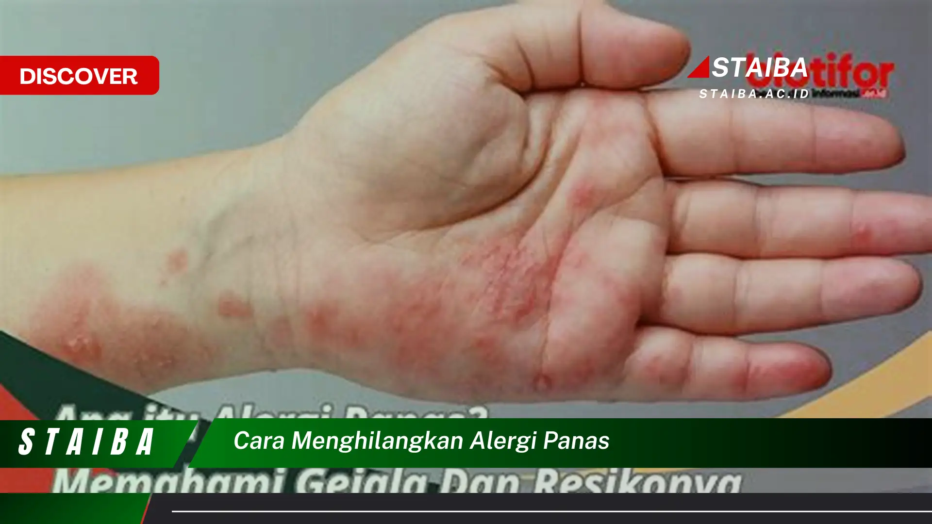 cara menghilangkan alergi panas