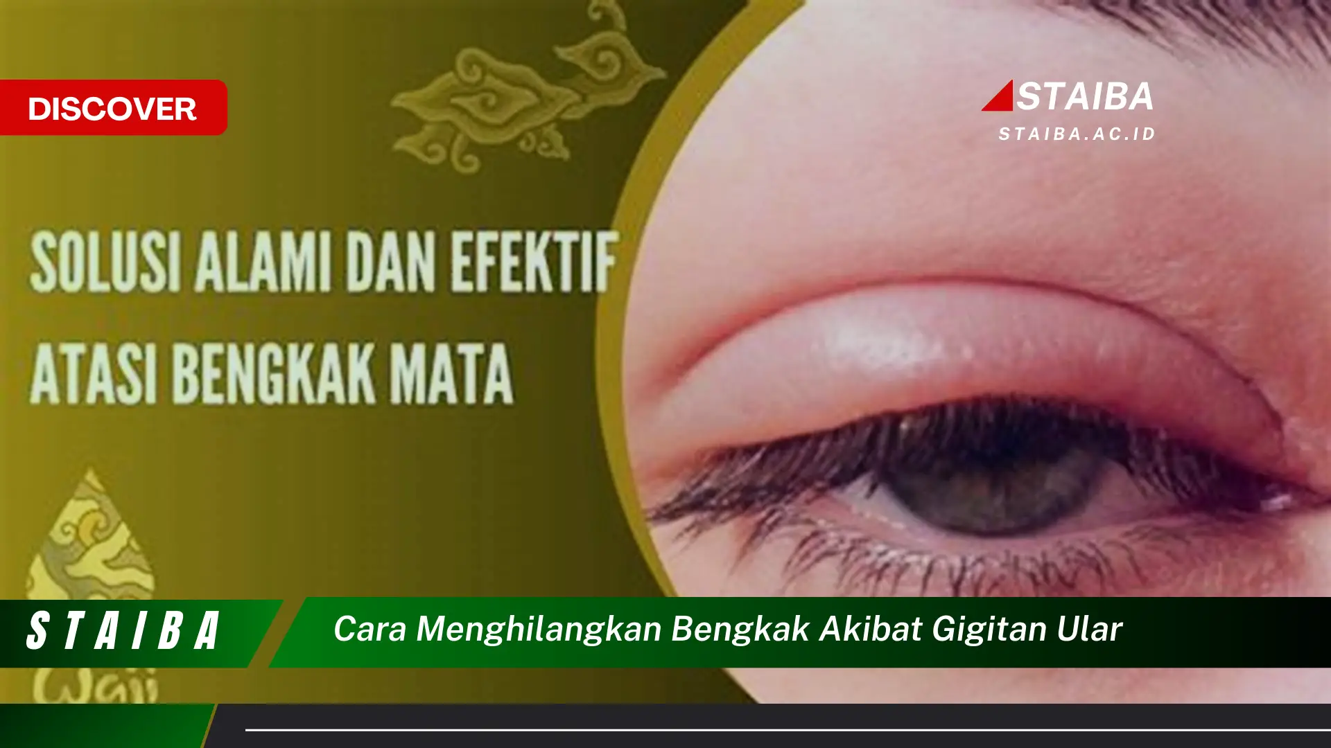 cara menghilangkan bengkak akibat gigitan ular