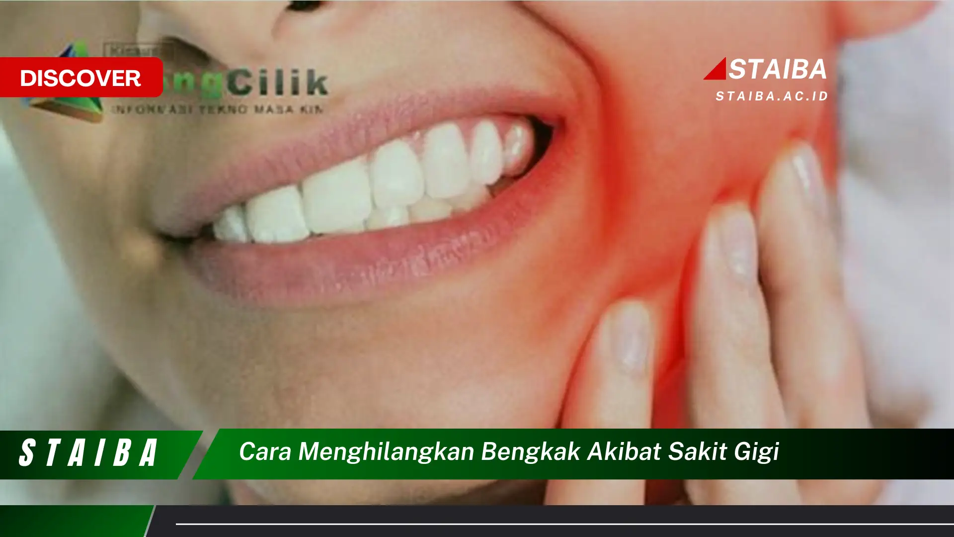 cara menghilangkan bengkak akibat sakit gigi