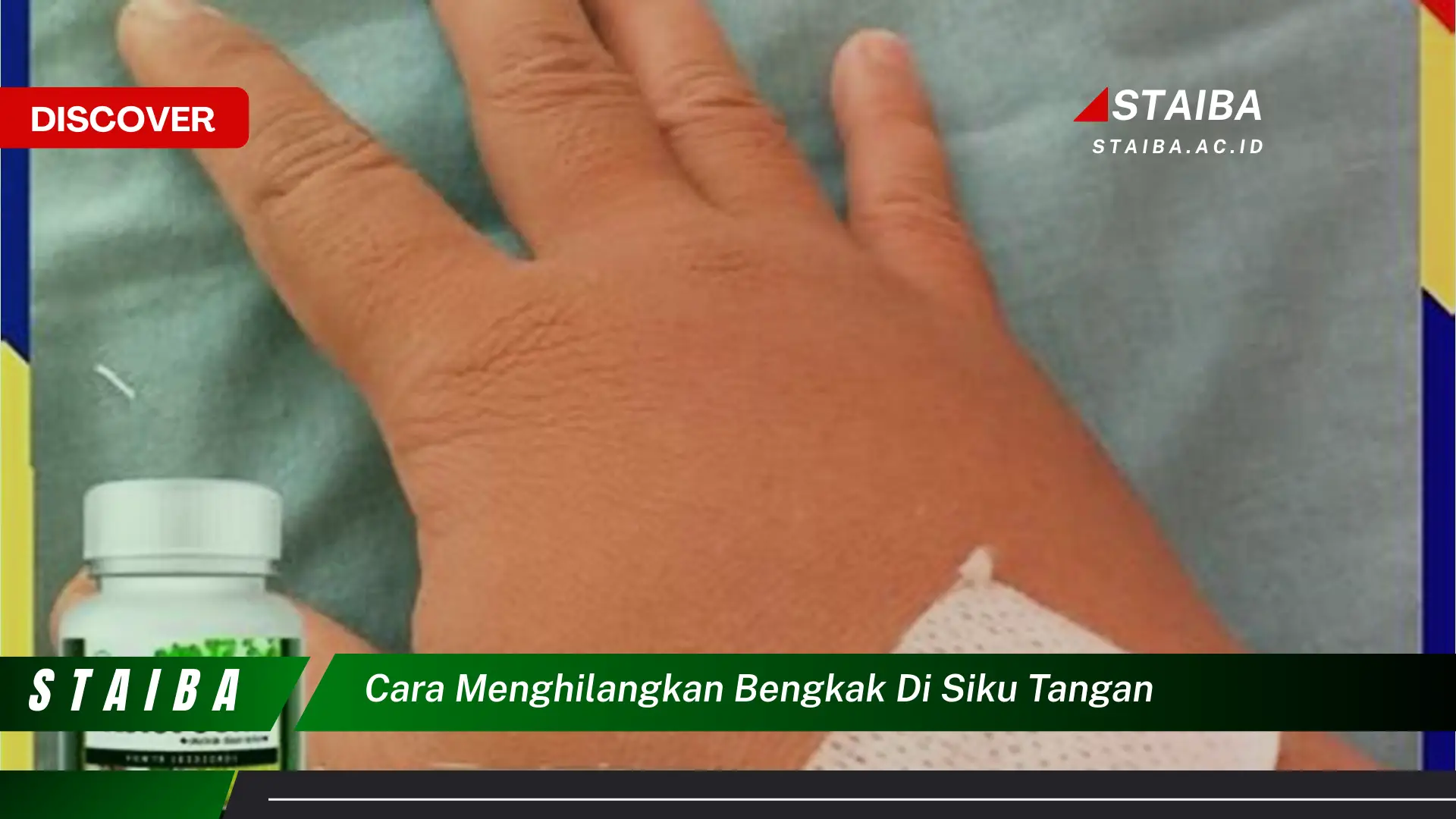 cara menghilangkan bengkak di siku tangan