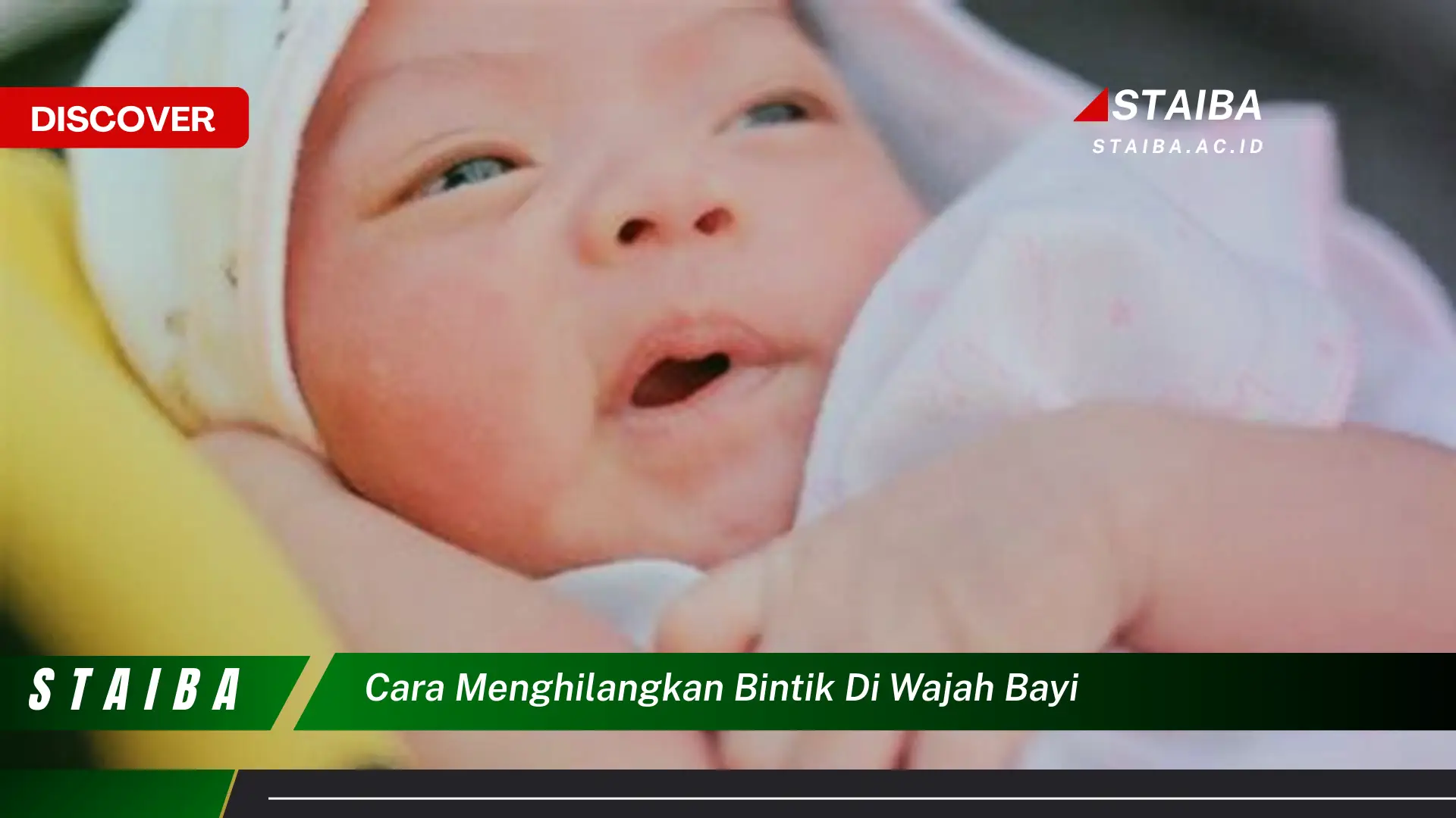 cara menghilangkan bintik di wajah bayi