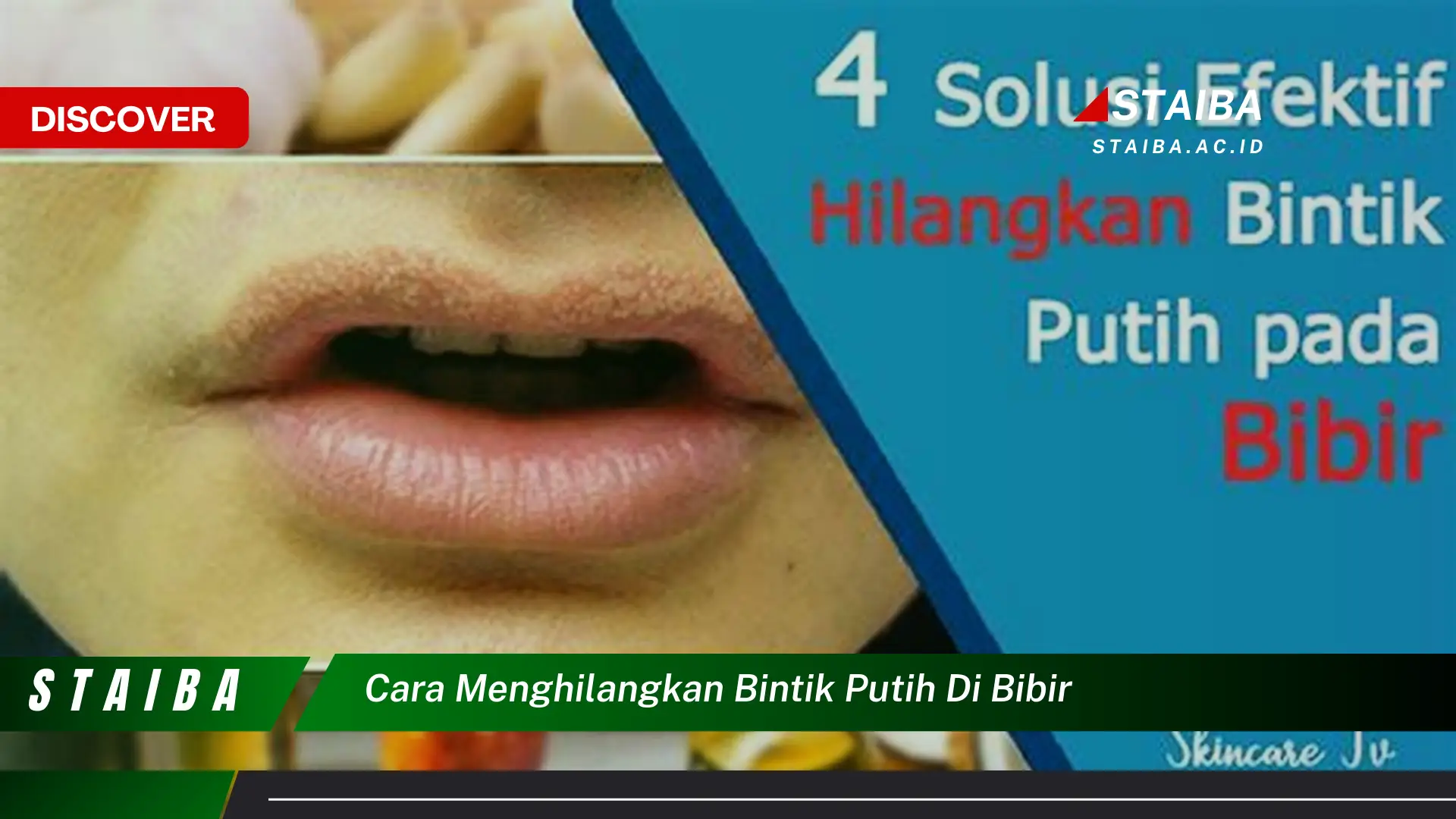 cara menghilangkan bintik putih di bibir