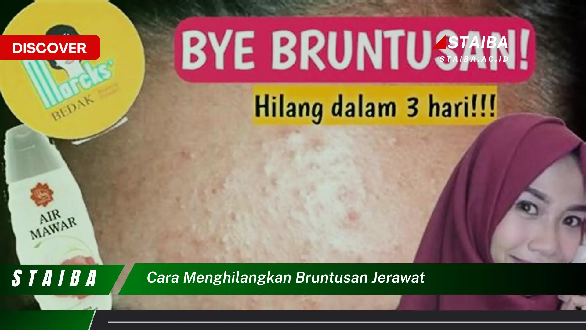 cara menghilangkan bruntusan jerawat