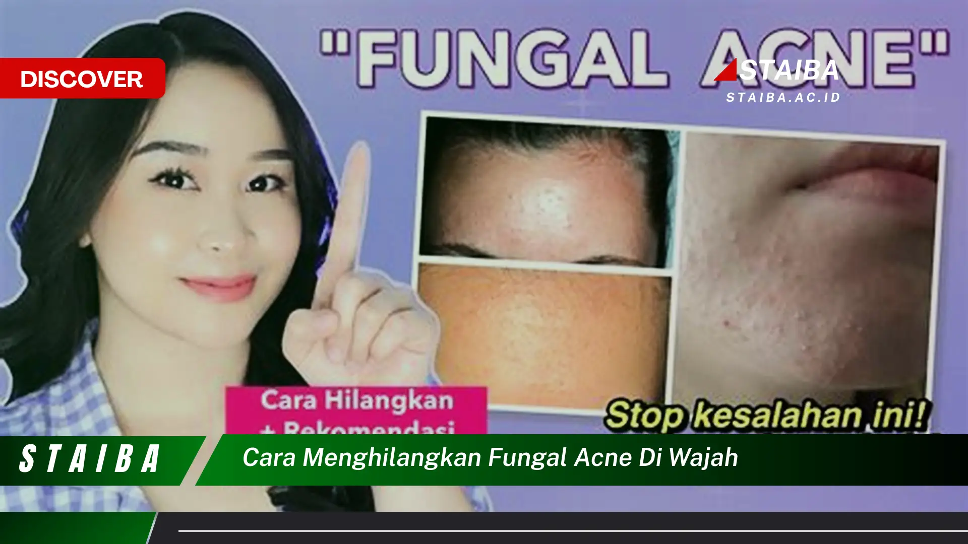 cara menghilangkan fungal acne di wajah