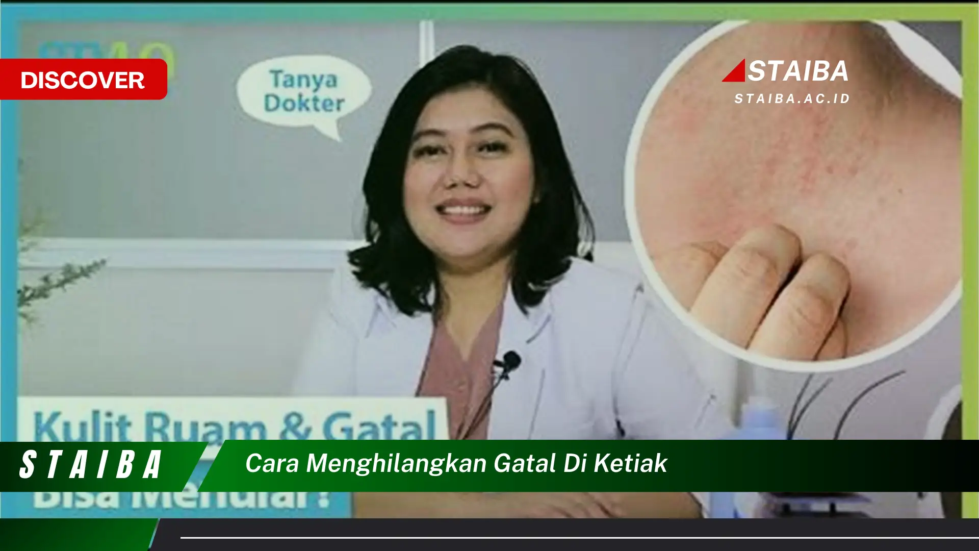 cara menghilangkan gatal di ketiak