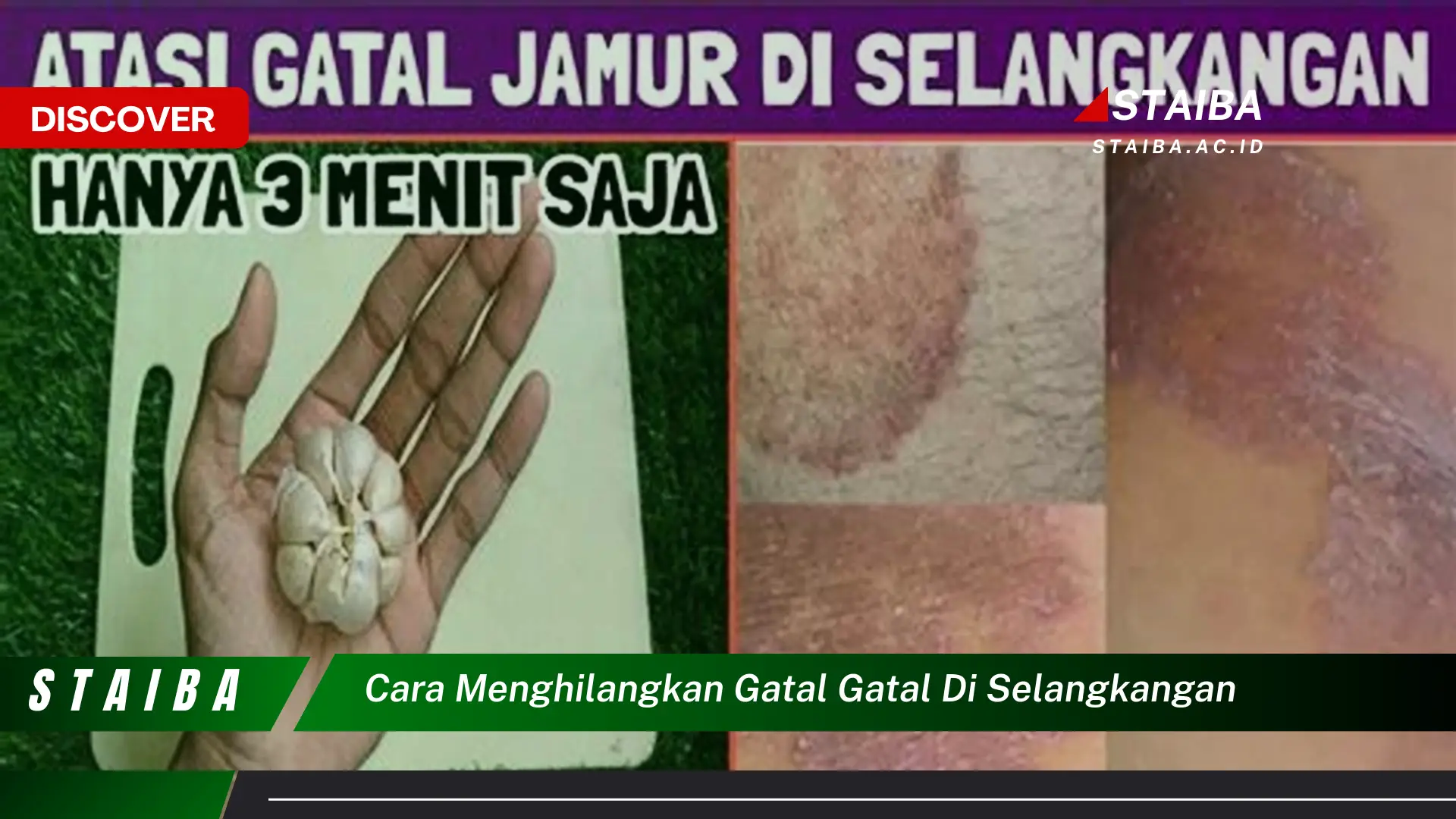 cara menghilangkan gatal gatal di selangkangan