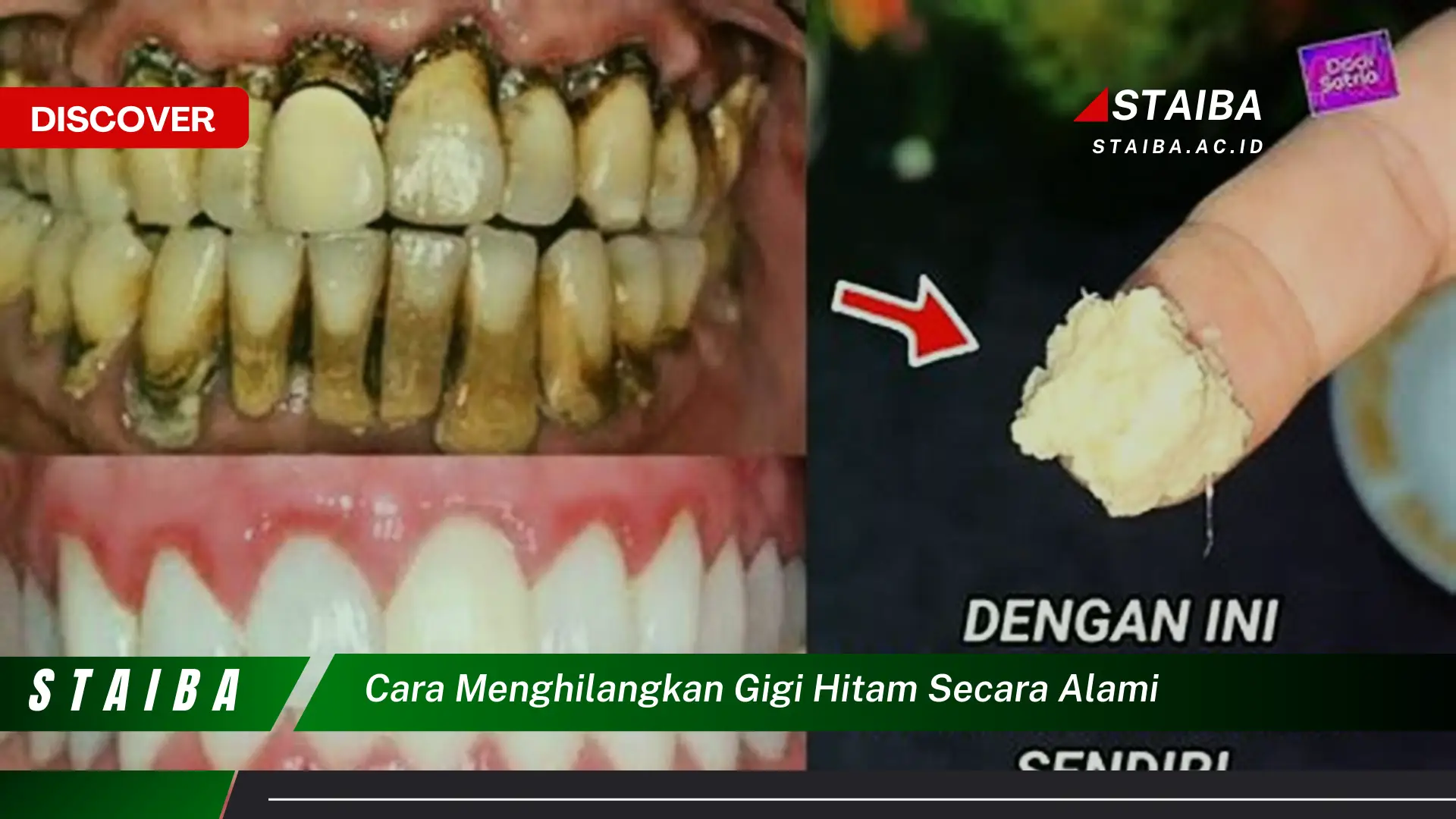 cara menghilangkan gigi hitam secara alami