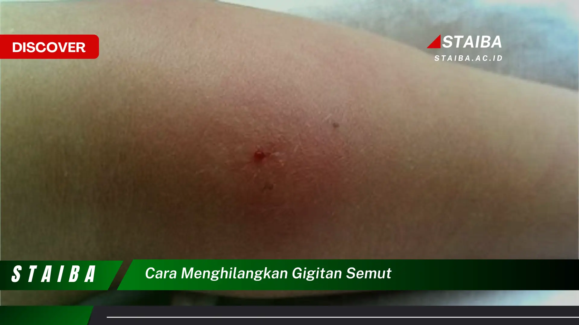 cara menghilangkan gigitan semut