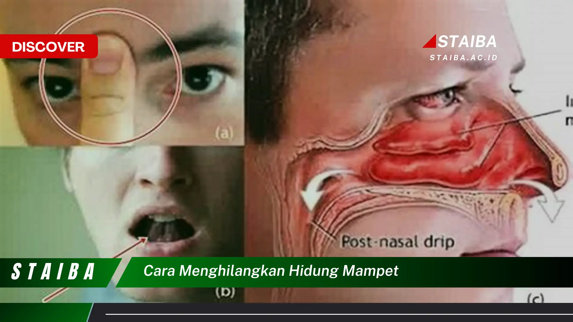 cara menghilangkan hidung mampet