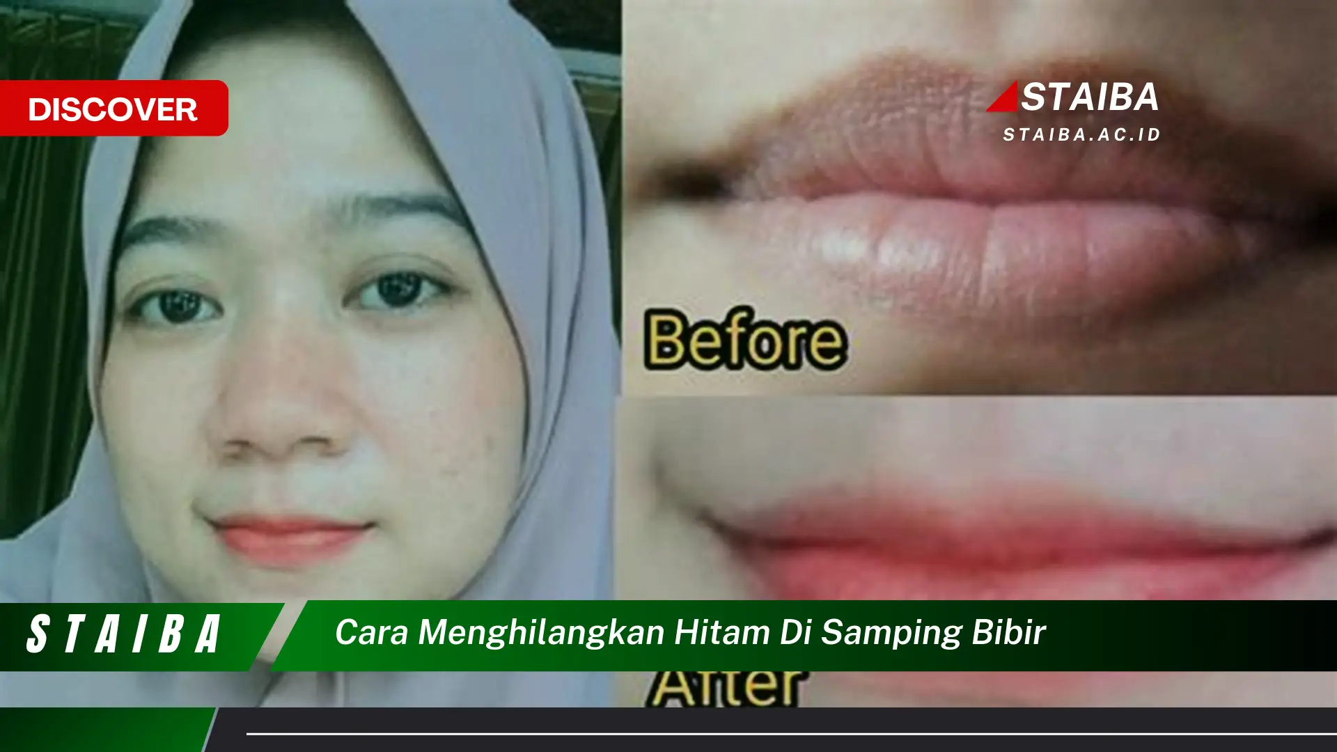 cara menghilangkan hitam di samping bibir