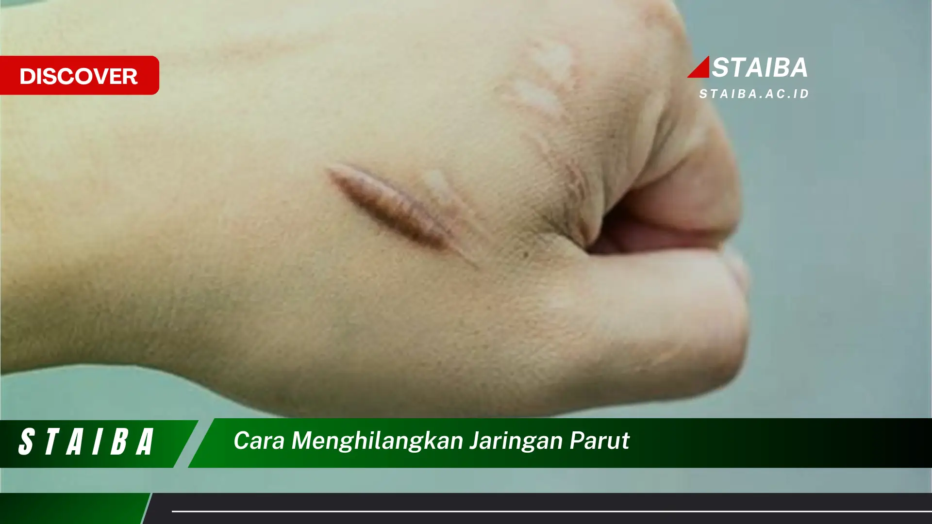 cara menghilangkan jaringan parut