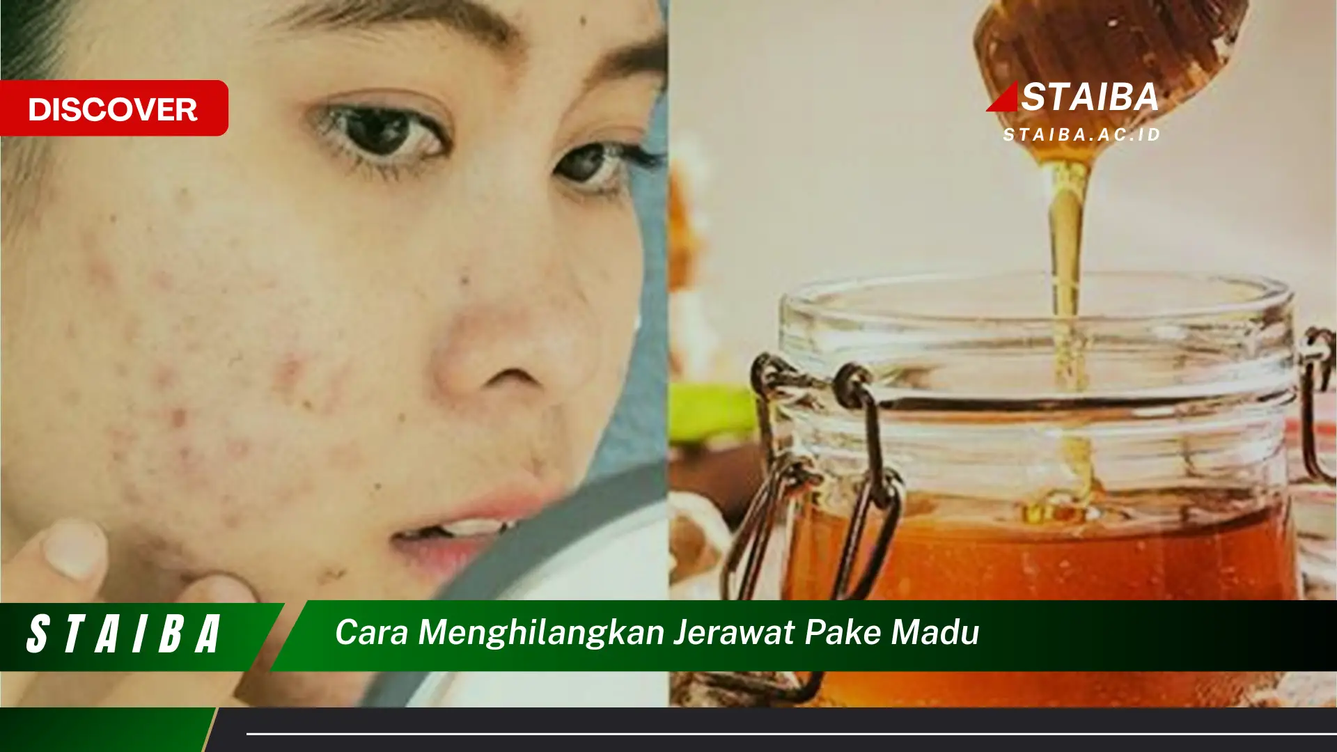 cara menghilangkan jerawat pake madu